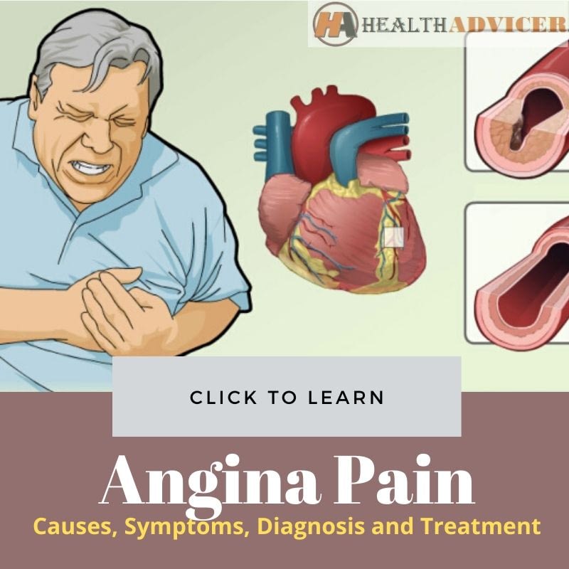Angina Pain Picture