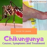 Chikungunya Causes Treatment