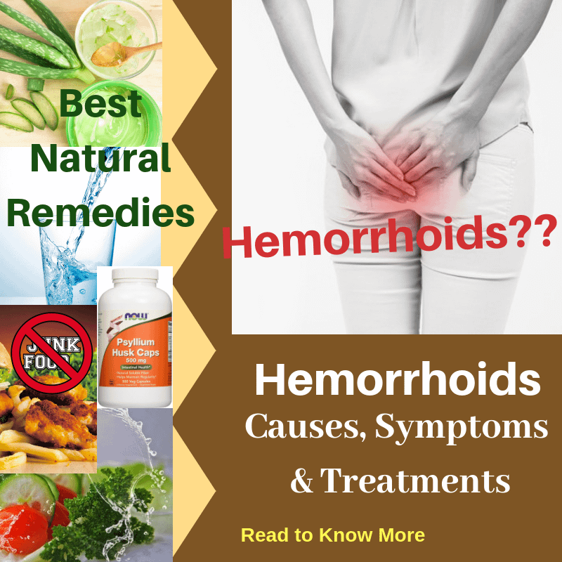 Hemorrhoids