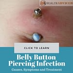 Infected Belly Button Piercing Picture