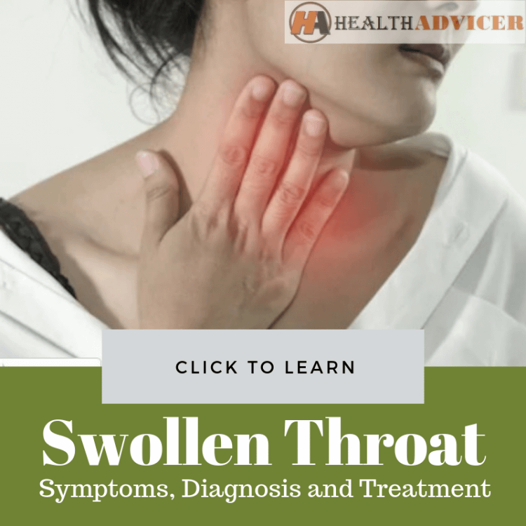 Swollen Throat And Difficulty In Swallowing