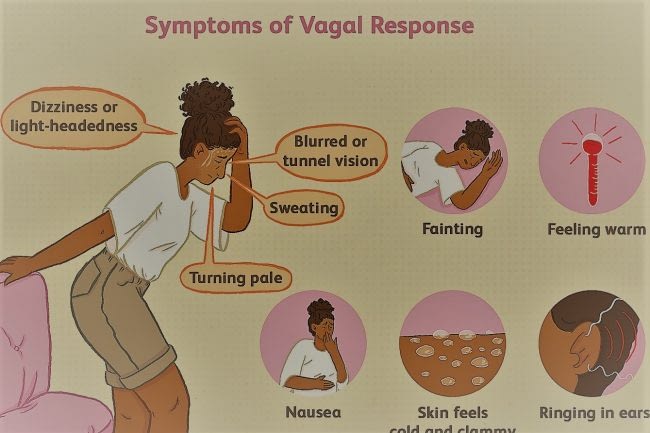 Vasovagal Syncope